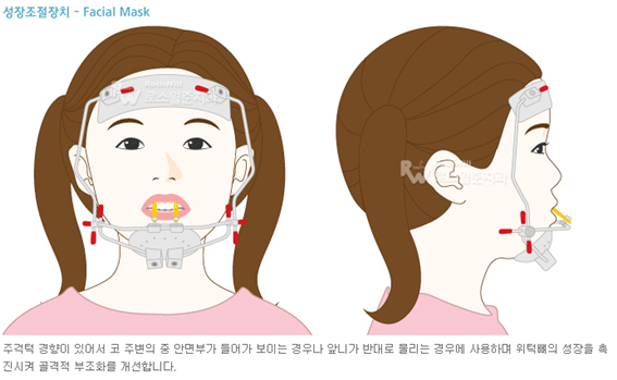 교정치료시기01.png